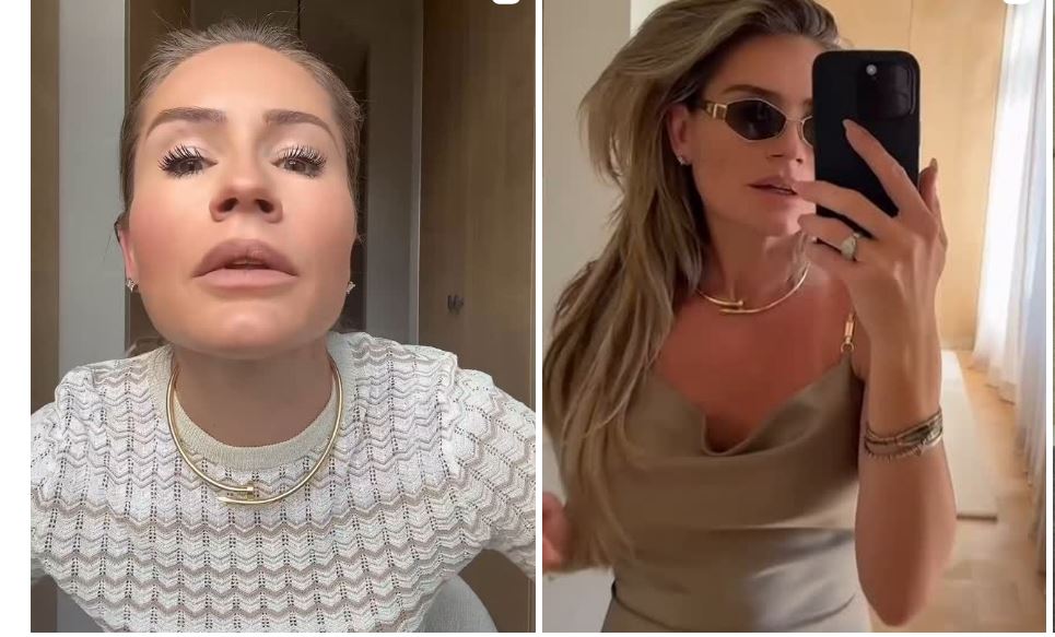 Nikkie Plessen Plastische Chirurgie