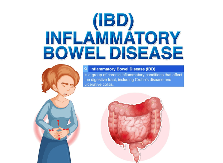 La maladie inflammatoire chronique La maladie inflammatoire chronique