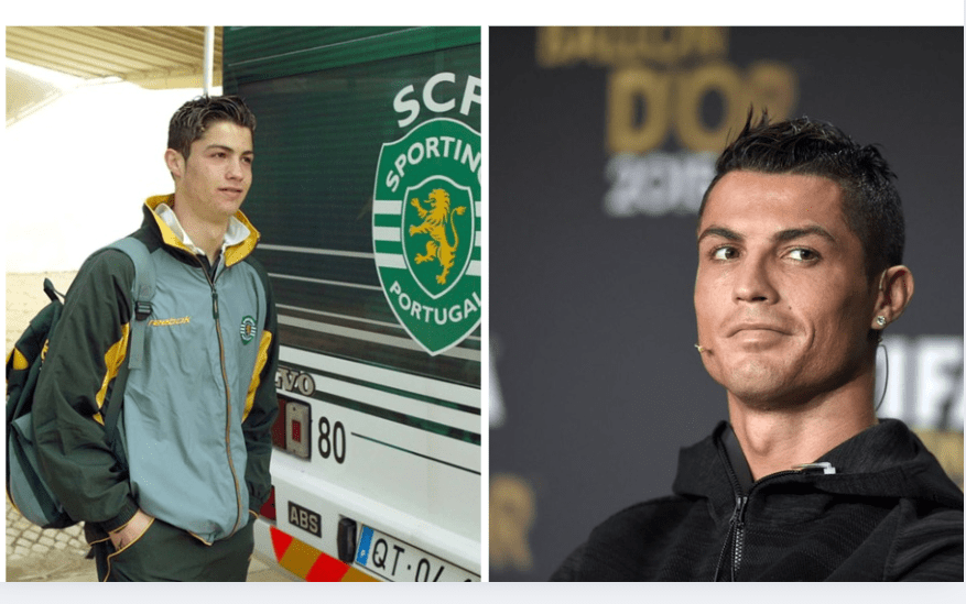 chirurgie plastique de Ronaldo chirurgie plastique de Ronaldo